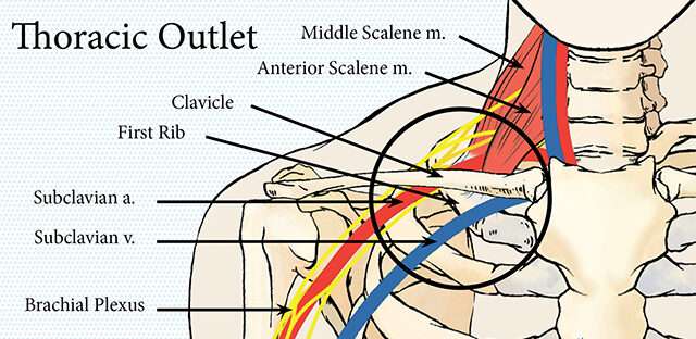 injury blog: thoracic outlet syndrome
