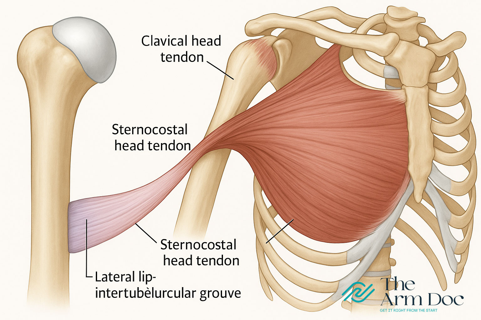 Pectoralis Major Tendon Rupture