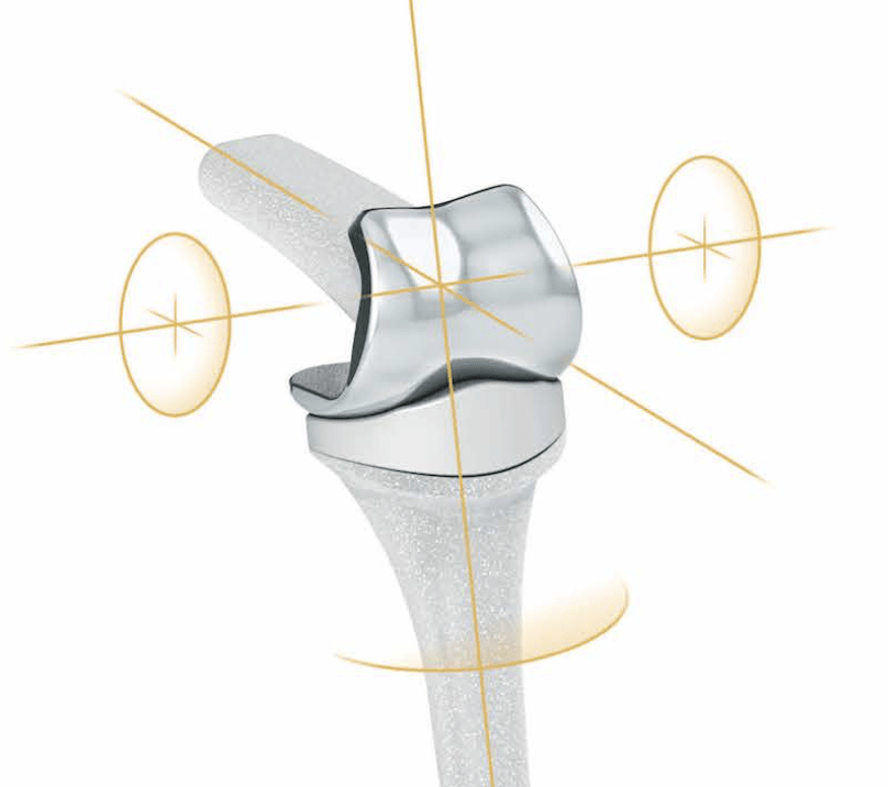 The ArmDoc Finger joint replacement