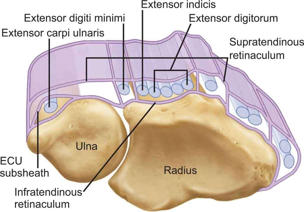 The ArmDoc - Extensor Carpi Ulnaris Subluxation